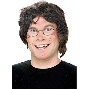 Warts, Pimples and Moles