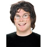 Warts, Pimples & Moles